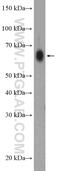 Zinc Finger CCHC-Type Containing 7 antibody, 22412-1-AP, Proteintech Group, Western Blot image 