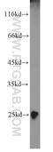 Troponin I1, Slow Skeletal Type antibody, 16102-1-AP, Proteintech Group, Western Blot image 