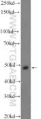 Serine/Threonine Kinase 25 antibody, 25821-1-AP, Proteintech Group, Western Blot image 