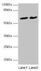 Intestinal and kidney-enriched PDZ protein antibody, CSB-PA774807LA01HU, Cusabio, Western Blot image 