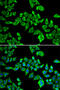 DEAD-Box Helicase 20 antibody, 19-877, ProSci, Immunofluorescence image 