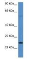 RAS Like Estrogen Regulated Growth Inhibitor antibody, NBP1-79772, Novus Biologicals, Western Blot image 