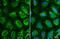 Chaperonin Containing TCP1 Subunit 5 antibody, NBP2-43680, Novus Biologicals, Immunocytochemistry image 