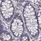 IKBKB Interacting Protein antibody, PA5-58491, Invitrogen Antibodies, Immunohistochemistry paraffin image 