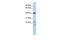 Secernin 2 antibody, GTX44842, GeneTex, Western Blot image 