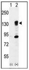 Integrin Subunit Alpha 5 antibody, AP52251PU-N, Origene, Western Blot image 