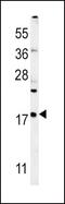 Vesicle Associated Membrane Protein 4 antibody, PA5-25755, Invitrogen Antibodies, Western Blot image 