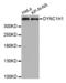 Dynein Cytoplasmic 1 Heavy Chain 1 antibody, STJ27712, St John