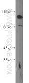 Epidermal Growth Factor Receptor Pathway Substrate 15 Like 1 antibody, 21243-1-AP, Proteintech Group, Western Blot image 