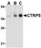 C1q And TNF Related 5 antibody, NBP1-76631, Novus Biologicals, Western Blot image 