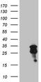 O-6-Methylguanine-DNA Methyltransferase antibody, LS-C798659, Lifespan Biosciences, Western Blot image 