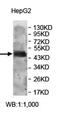 Zinc Finger Protein 322 antibody, orb78044, Biorbyt, Western Blot image 