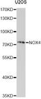 NADPH Oxidase 4 antibody, A11274, ABclonal Technology, Western Blot image 