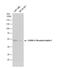 Gamma-Aminobutyric Acid Type A Receptor Alpha1 Subunit antibody, NBP2-16565, Novus Biologicals, Western Blot image 