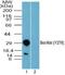 BCR Activator Of RhoGEF And GTPase antibody, NBP2-24460, Novus Biologicals, Western Blot image 