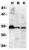 TNF Receptor Superfamily Member 6b antibody, 2140, QED Bioscience, Western Blot image 