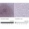 Major Histocompatibility Complex, Class II, DO Alpha antibody, NBP1-91993, Novus Biologicals, Immunohistochemistry paraffin image 