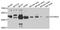 StAR Related Lipid Transfer Domain Containing 3 antibody, STJ110087, St John