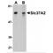 Solute Carrier Family 37 Member 2 antibody, MBS151110, MyBioSource, Western Blot image 