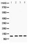 Cystatin B antibody, PB9565, Boster Biological Technology, Western Blot image 