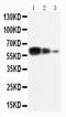 ADAM Metallopeptidase Domain 10 antibody, PA1535, Boster Biological Technology, Western Blot image 