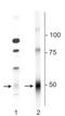 Gamma-Aminobutyric Acid Type A Receptor Delta Subunit antibody, NB300-200, Novus Biologicals, Western Blot image 
