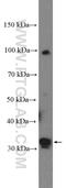 Phosphoribosyl Pyrophosphate Synthetase 2 antibody, 27024-1-AP, Proteintech Group, Western Blot image 