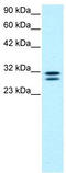 HIV-1 Tat Interactive Protein 2 antibody, TA331157, Origene, Western Blot image 