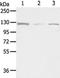 Ubiquitin Like Modifier Activating Enzyme 1 antibody, TA351884, Origene, Western Blot image 