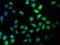 TAO Kinase 1 antibody, CSB-PA752101LA01HU, Cusabio, Immunofluorescence image 