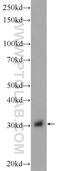 Glucosamine-6-Phosphate Deaminase 2 antibody, 17105-1-AP, Proteintech Group, Western Blot image 