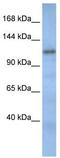 Cullin Associated And Neddylation Dissociated 2 (Putative) antibody, TA339710, Origene, Western Blot image 