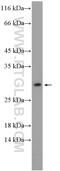 Motile Sperm Domain Containing 3 antibody, 26168-1-AP, Proteintech Group, Western Blot image 