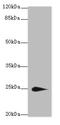 Transmembrane Protein 174 antibody, A61378-100, Epigentek, Western Blot image 