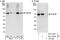 NOP56 Ribonucleoprotein antibody, NBP1-46847, Novus Biologicals, Western Blot image 