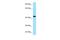 GDP-Mannose Pyrophosphorylase B antibody, PA5-69559, Invitrogen Antibodies, Western Blot image 