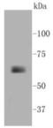 Matrix Metallopeptidase 14 antibody, NBP2-67415, Novus Biologicals, Western Blot image 