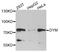 Dymeclin antibody, STJ110521, St John