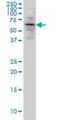 5'-Aminolevulinate Synthase 2 antibody, H00000212-M01, Novus Biologicals, Western Blot image 