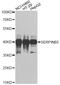 Serpin Family B Member 5 antibody, A1179, ABclonal Technology, Western Blot image 