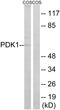 3-phosphoinositide-dependent protein kinase 1 antibody, LS-C199425, Lifespan Biosciences, Western Blot image 