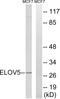 ELOVL Fatty Acid Elongase 5 antibody, A30674, Boster Biological Technology, Western Blot image 