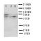 Hexosaminidase Subunit Alpha antibody, orb76300, Biorbyt, Western Blot image 