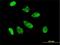 Caudal Type Homeobox 1 antibody, H00001044-M01, Novus Biologicals, Immunocytochemistry image 