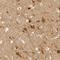 Discs Large MAGUK Scaffold Protein 3 antibody, NBP1-87691, Novus Biologicals, Immunohistochemistry paraffin image 