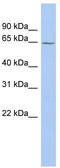 Monoamine Oxidase A antibody, TA335133, Origene, Western Blot image 