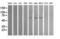 Aldehyde Dehydrogenase 1 Family Member A3 antibody, M03030, Boster Biological Technology, Western Blot image 