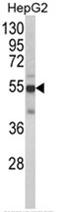 Cytochrome P450 Family 2 Subfamily J Member 2 antibody, AP17970PU-N, Origene, Western Blot image 