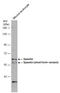 Spastin antibody, GTX130877, GeneTex, Western Blot image 