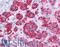 RAD51 Recombinase antibody, LS-B4573, Lifespan Biosciences, Immunohistochemistry paraffin image 